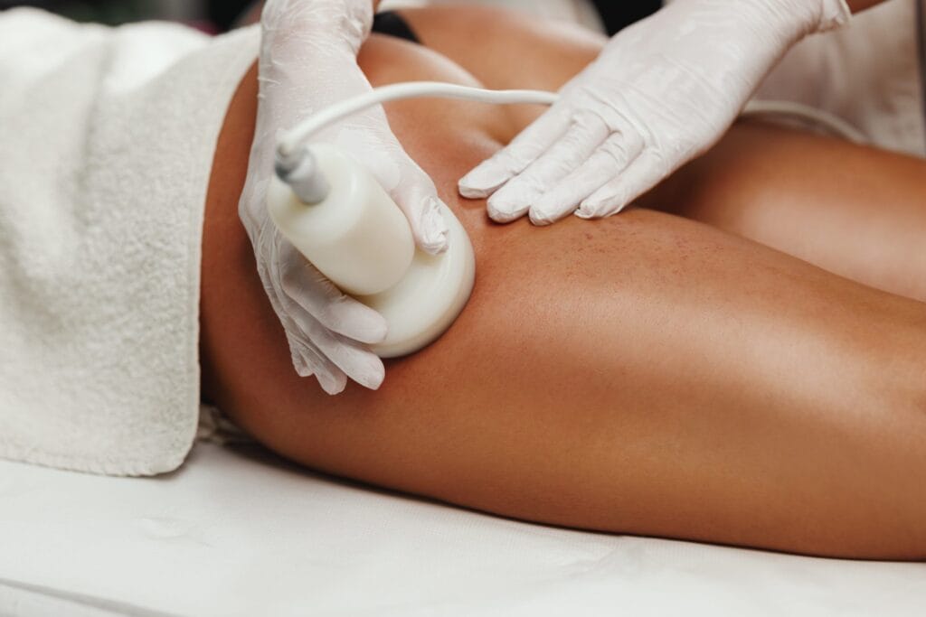 ultrasound-cavitation-body-contouring-treatment-2022-08-18-07-42-31-utc-scaled